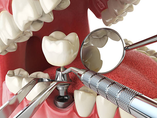 Best Emergency Dental Care for Abscessed Tooth in Cotter, AR